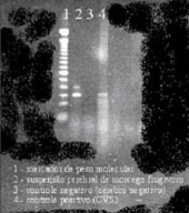 Fig. 2 - DRT-PCR do material cerebral de quiróptero frugívoro (Artibeus literatus)